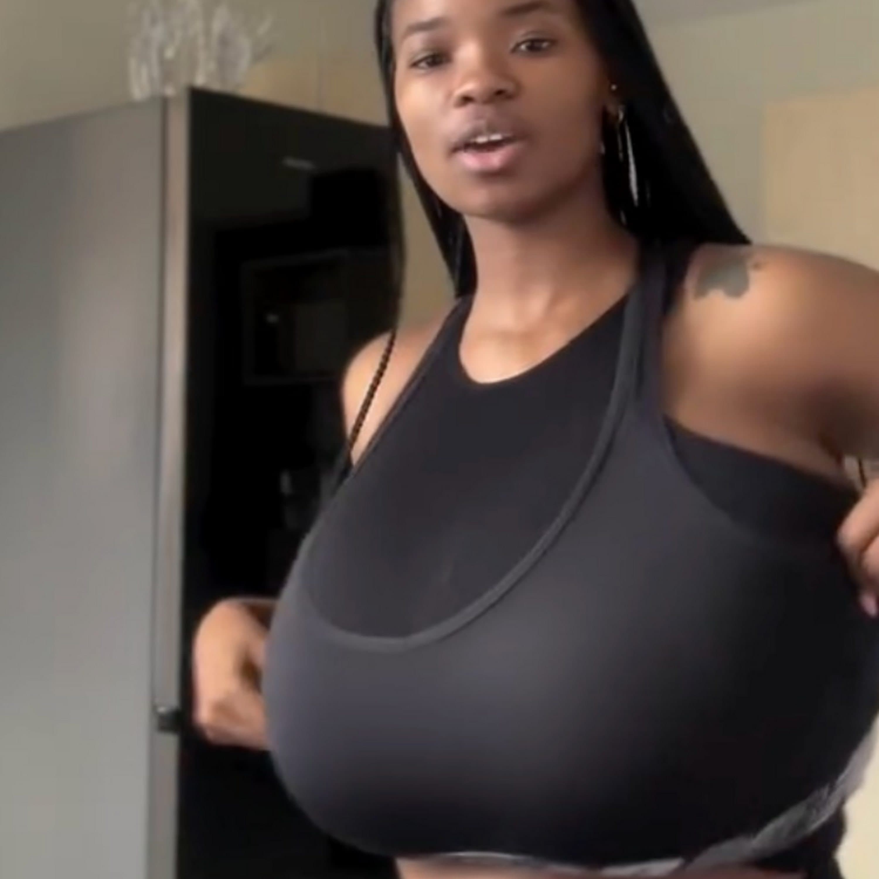 Gigantomastia: Living with my oversized breasts