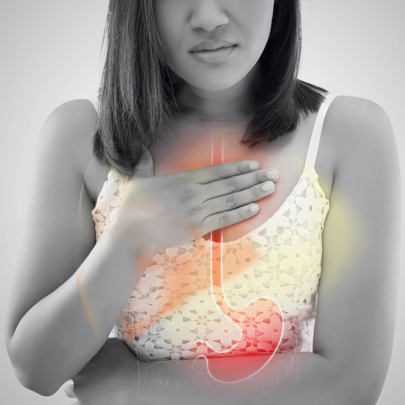 EKU2021.2: Gastroesophageal Reflux Disease 
