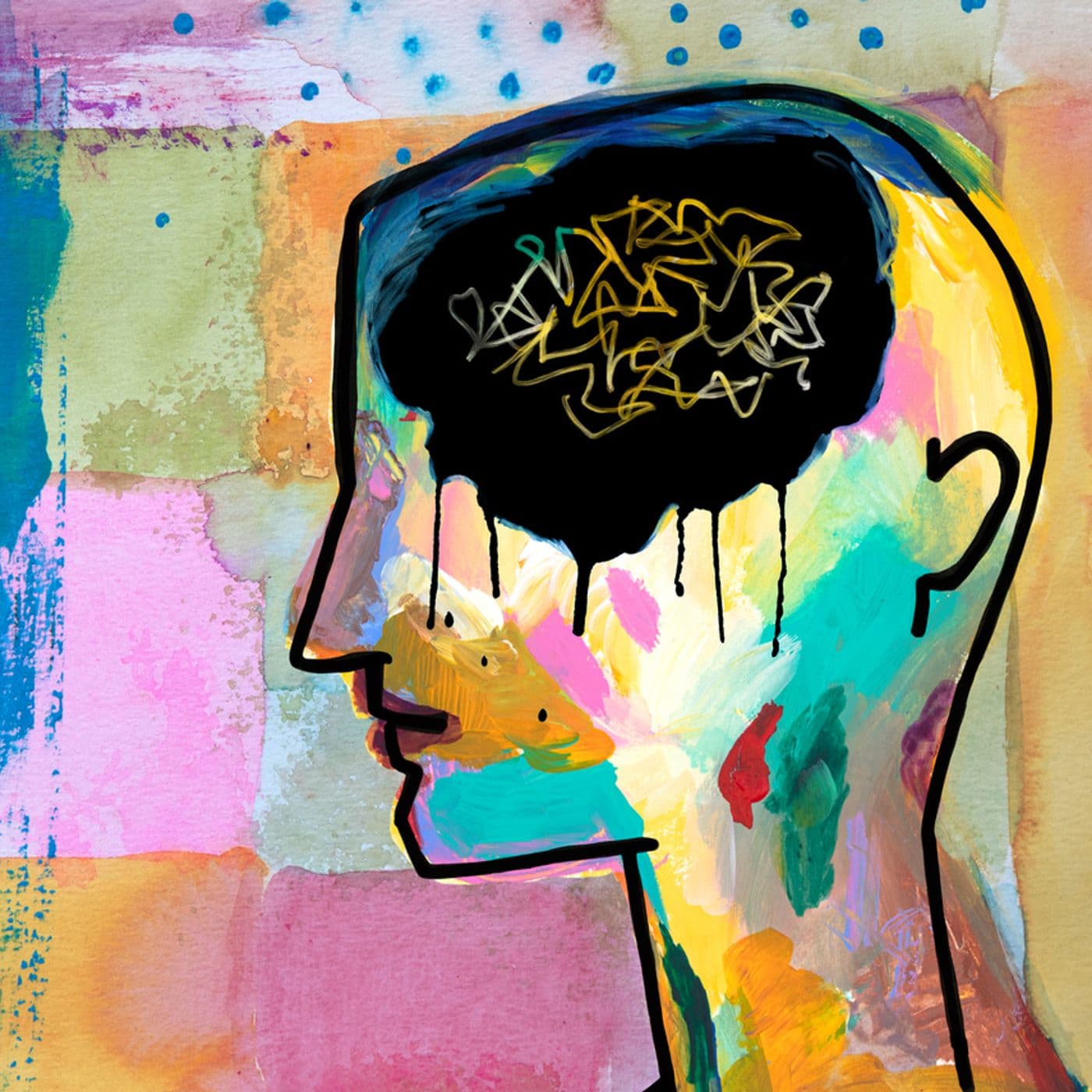 Newer therapies in migraine prevention