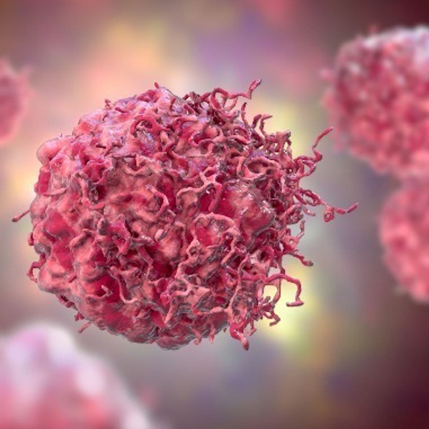 Cancer detection