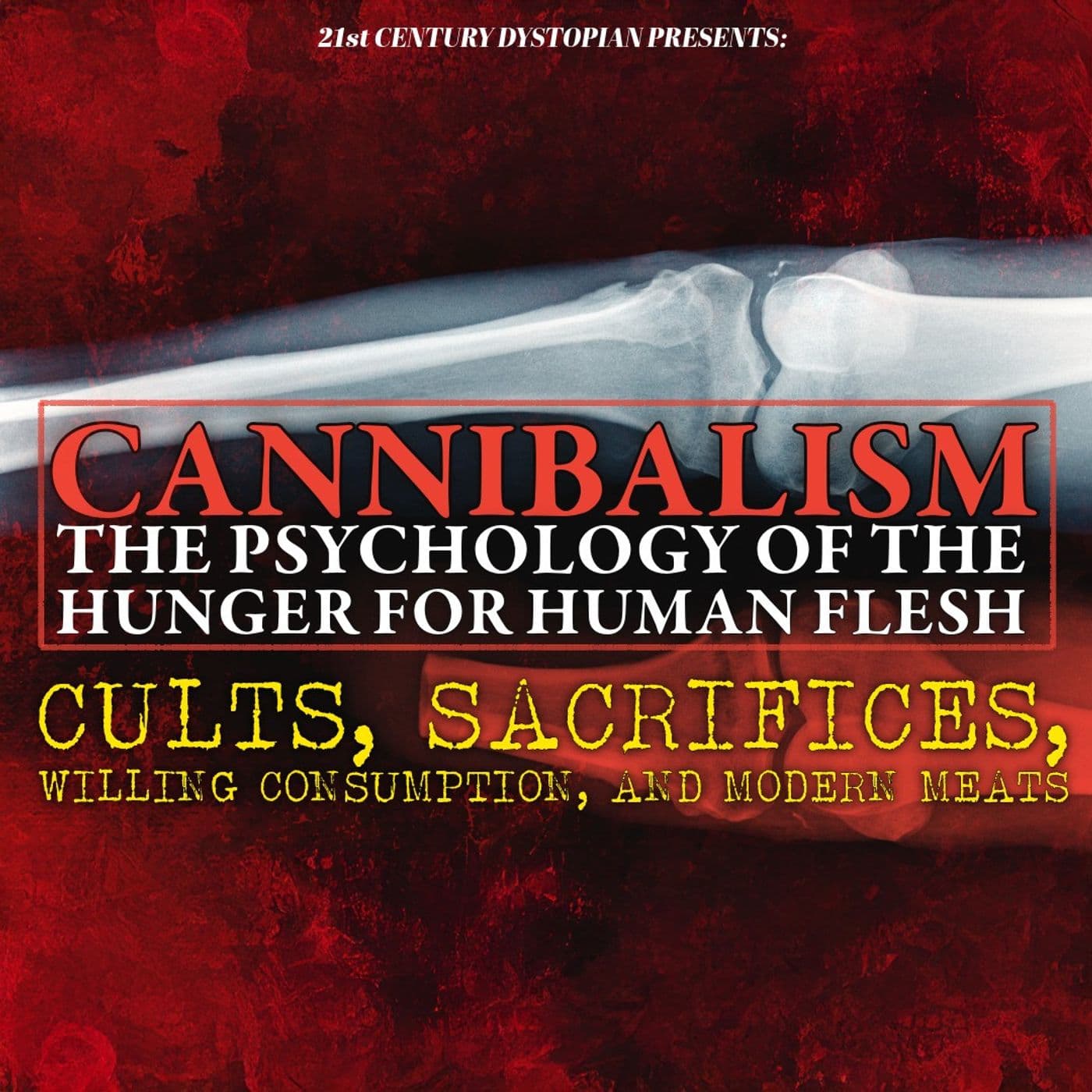CANNIBALISM: The Hunger Humanity Can't Satisfy