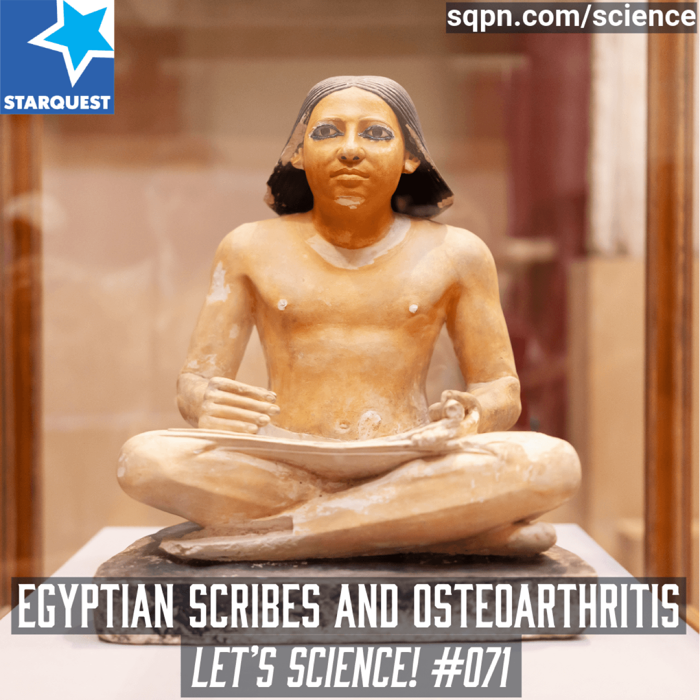 Egyptian Scribes and Osteoarthritis