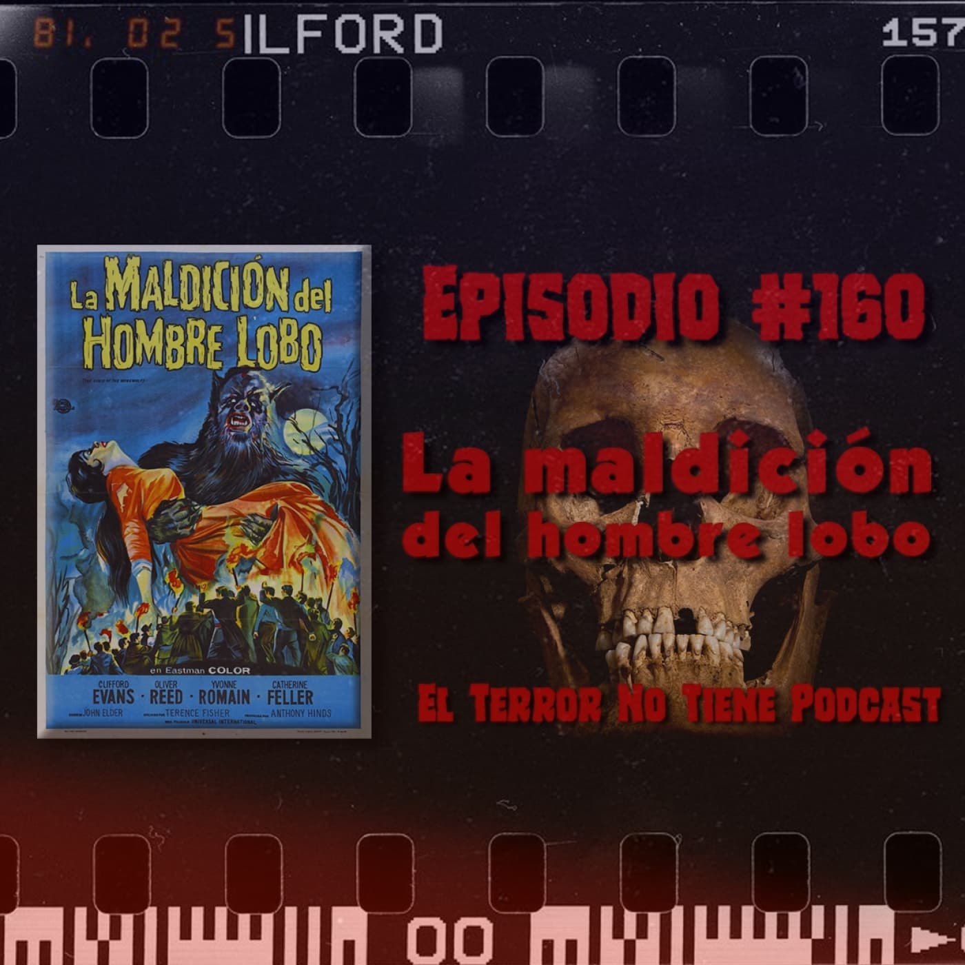 El Terror No Tiene Podcast - Episodio #160 - La Maldición Del Hombre Lobo
