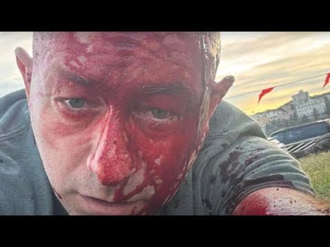 Making Sense of the Bondi Beach Massacre